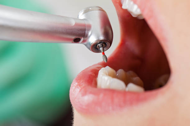 Best Emergency Root Canal Treatment in Highland Village, TX